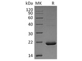 Recombinant Human Cytochrome b5 B/CYB5B Protein (His Tag)