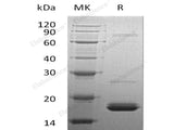 Recombinant Human Cytochrome b5/CYB5A Protein (His Tag)