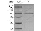 Recombinant Human UQCRH Protein (GST Tag)