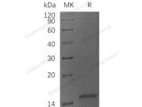 Recombinant Human Cytochrome C/CYCS Protein (His Tag)