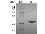 Recombinant Human Cytoglobin/CYGB Protein (His Tag)