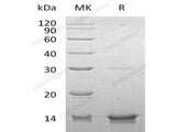 Recombinant Human DYNLL1 Protein (His Tag)