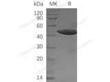 Recombinant Human NCK1 Protein (His Tag)