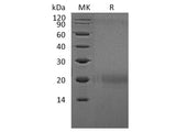 Recombinant Human CTLA4 Protein (Flag Tag) 