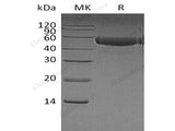 Recombinant Human CTLA4 Protein (Fc Tag)