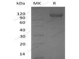 Recombinant Human DCBLD2/ESDN Protein (aa 67-528, His Tag)