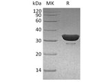 Recombinant Human DCUN1D1 Protein (His Tag)