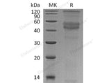 Recombinant Human DMP1 Protein (His Tag)