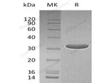 Recombinant Human Deoxycytidine Kinase/DCK Protein (His &T7 Tag)