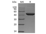 Recombinant Human DHPS Protein (His Tag)