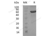 Recombinant Human Dermatopontin/DPT Protein (Fc & His Tag)