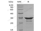 Recombinant Human Desmin Protein (His Tag)