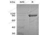 Recombinant Human Diamine Oxidase/AOC1 Protein (His Tag)