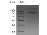 Recombinant Human DKK3 Protein (His Tag)