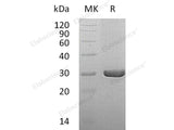 Recombinant Human Dihydropteridine Reductase/QDPR Protein (His Tag) 