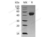 Recombinant Human Dipeptidase 1/DPEP1 Protein (His Tag)