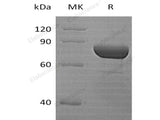 Recombinant Human DPP3 Protein (His Tag)