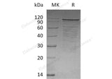 Recombinant Human DLG4 Protein (His Tag)