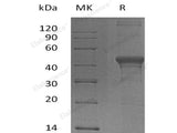 Recombinant Human DFFA Protein (His Tag) 