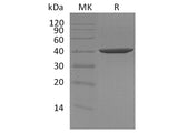 Recombinant Human DNA Polymerase β/POLB Protein (His Tag)