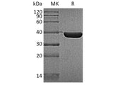 Recombinant Human HSP40/DNAJB1 Protein (His Tag)