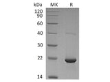 Recombinant Human dUTPase Protein (His Tag)