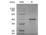 Recombinant Human BDH1 Protein (His Tag)