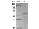 Recombinant Human STUB1 Protein