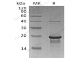 Recombinant Human EGR1 Protein (His Tag) 