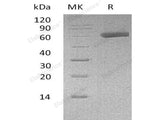 Recombinant Human EDIL3/Del-1 Protein (His Tag)