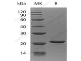 Recombinant Human EIF1AX Protein (His Tag)  