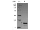 Recombinant Human 4E-BP1/EIF4EBP1 Protein (His Tag)