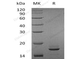 Recombinant Human EIF4EBP2 Protein (His Tag)