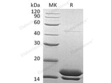 Recombinant Human PI3/Elafin Protein (His Tag)