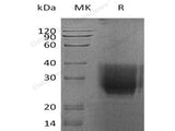 Recombinant Human CD147/Basigin Protein (His Tag)