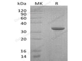 Recombinant Human Endoglin/CD105 Protein (His&Trx Tag)