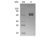 Recombinant Human ESAM Protein (aa 30-247, Fc Tag)