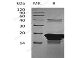 Recombinant Human EDF1/MBF1 Protein (His Tag)