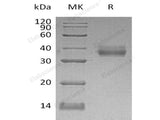 Recombinant Human EpCAM/TROP-1 Protein (His Tag)