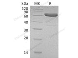 Recombinant Human EpCAM/TROP-1 Protein (Fc Tag) 