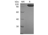 Recombinant Human EphA2 Protein (Fc Tag)(Active)