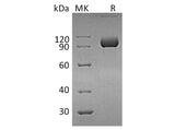 Recombinant Human EphA4 Protein (Fc Tag)