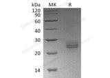 Recombinant Human Ephrin-A1/EFNA1 Protein (His Tag)(Active)