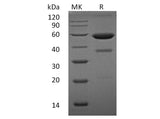 Recombinant Human Ephrin-A1/EFNA1 Protein (Fc Tag)(Active)