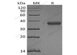 Recombinant Human Ephrin-A3/EFNA3 Protein (His Tag)