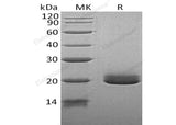 Recombinant Human Ephrin-A4/EFNA4 Protein (His Tag) 