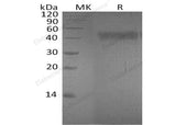 Recombinant Human Ephrin-A4/EFNA4 Protein (Fc & His Tag)(Active)