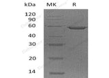 Recombinant Human Ephrin-A5/EFNA5 Protein (Fc Tag)