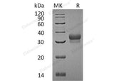 Recombinant Human Ephrin-B1/EFNB1 Protein (His Tag)