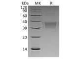 Recombinant Human Ephrin-B2/EFNB2 Protein (His Tag)(Active)